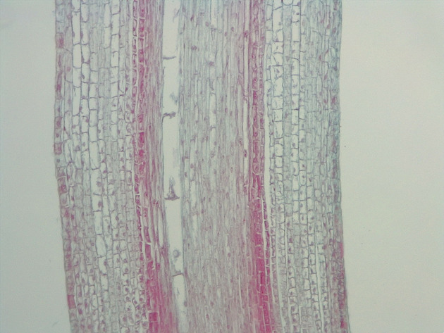 Dicot Root LS Slides - Dicot Root LS 04 100X